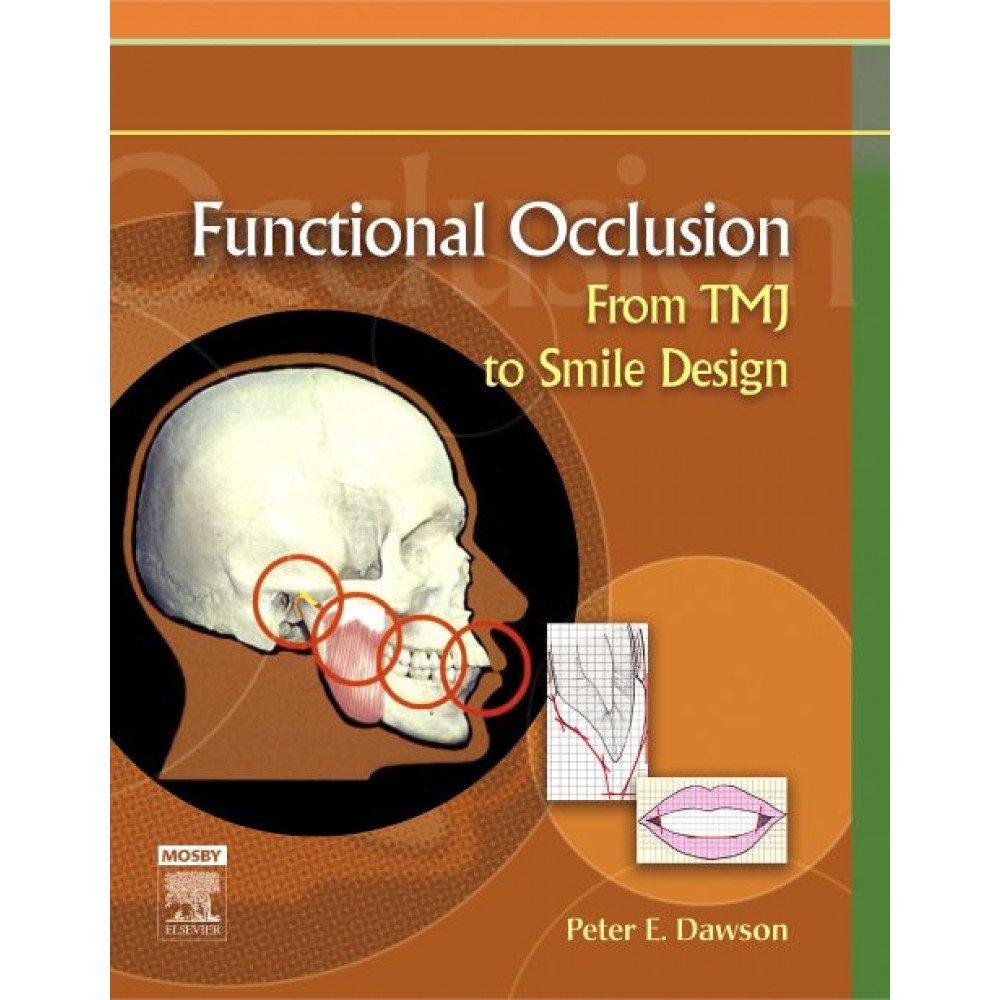 FUNCTIONAL OCCULUSION