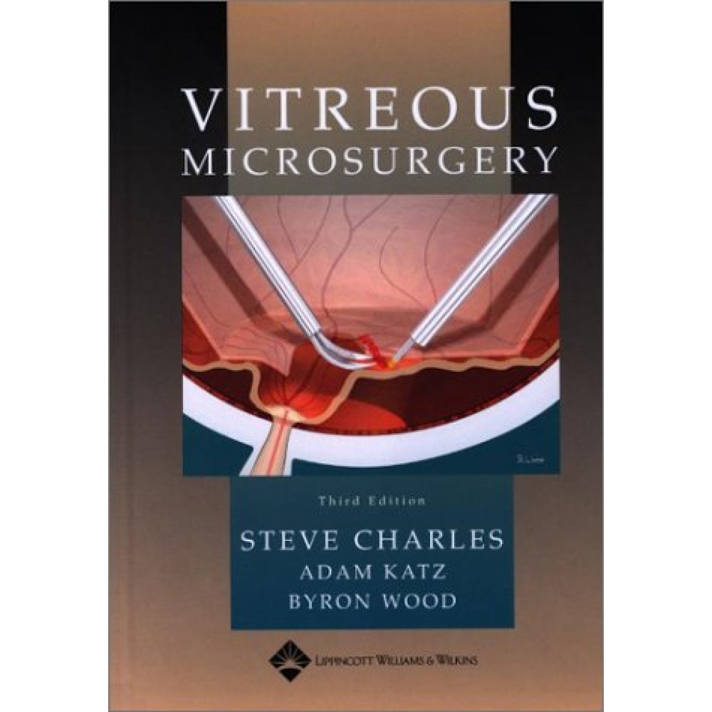 VITREOUS MICROSURGERY