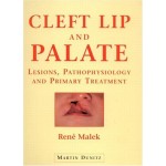 CLEFT LIP AND PALATE