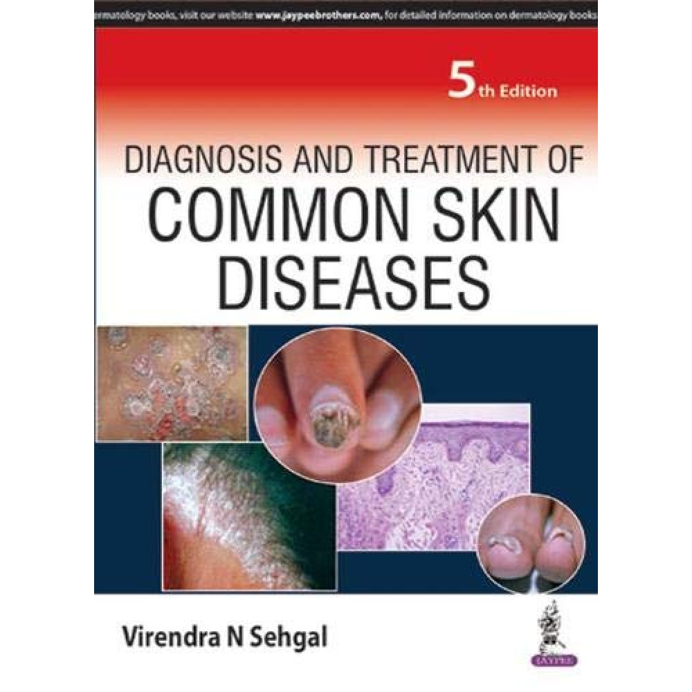 DIAGNOSIS AND TREATMENT OF COMMON SKIN DISEASES