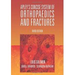 APLEY'S CONCISE SYSTEM OF ORTHOPAEDICS AND FRACTURES