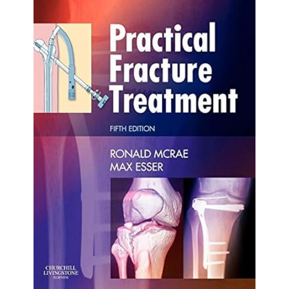 PRACTICAL FRACTURE TREATMENT