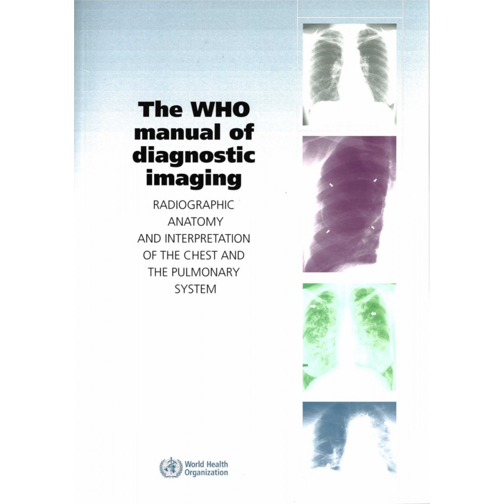 THE WHO MANUAL OF DIAGNSTIC IMAGING 